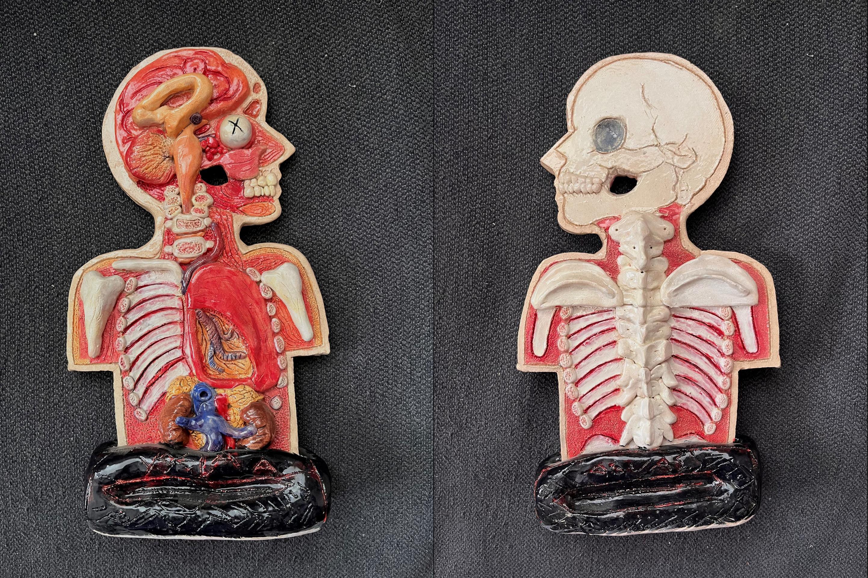 aguas fragile anatomy