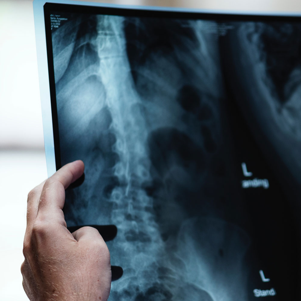 Man examines an x-ray